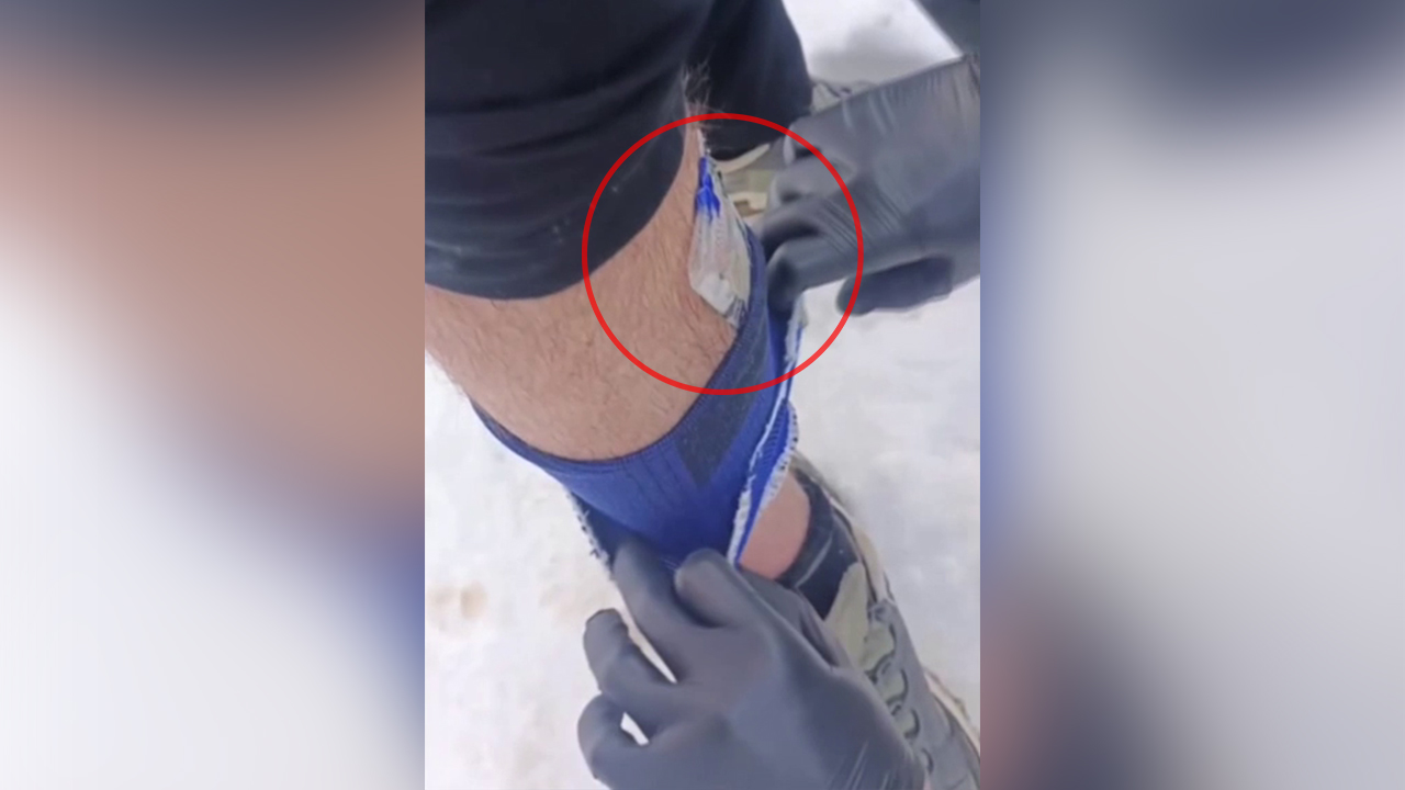 Полиция Мордовии задержала петербуржца, прятавшего партию пропитанных ЛСД марок под бандажом на ноге